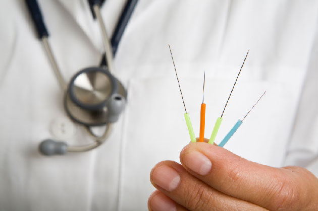 Etude de l�effet de l��lectroacupuncture chez des patients atteints de maladie de Parkinson