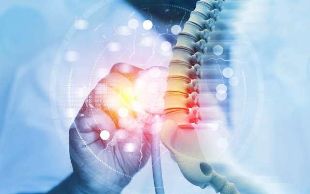 Traitement du rhumatisme psoriasique par ixkizumab : rsultats de l'tude DSP