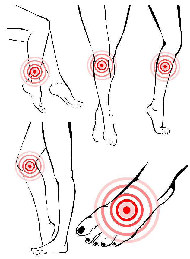 Traitement de l'arthrite psoriasique par anti-TNF alpha&nbsp;: quel impact des comorbidit�s&nbsp;?
