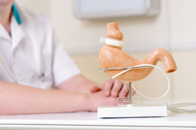La chirurgie bariatrique rduirait les vnements cardiovasculaires  long terme