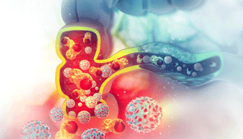 La coloscopie reste un examen redout�. La SNFGE cherche � lever les r�ticences