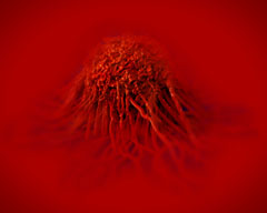 Le dabigatran reverse les effets sur la croissance tumorale et l'angiogen�se de la thrombine