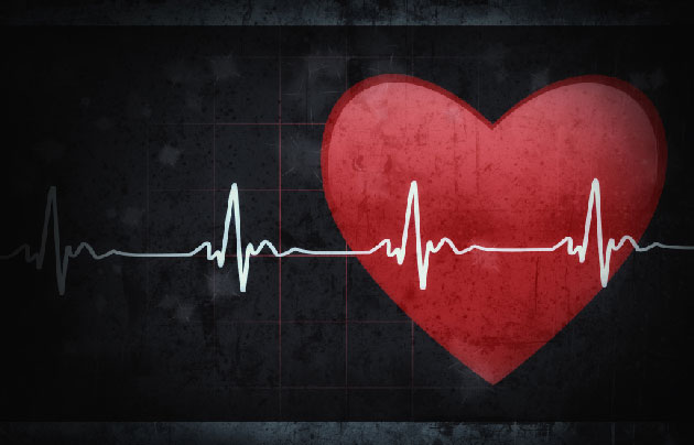 La stimulation cardiaque en boucle ferme semble efficace dans les syncopes rflexes rcurrentes svres avec asystolie