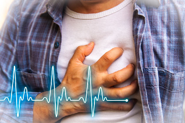 Augmentation du risque de MACE aprs initiation d'anti-IL12/23 et d'anti-IL17 pour du rhumatisme psoriasique : une tendance  confirmer