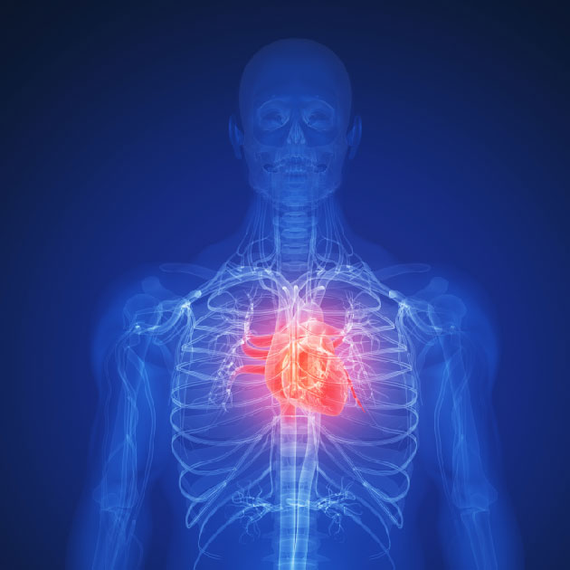 Suivi de 5 ans du registre PARTNER 2 Aortic Valve-in-Valve pour les bioprothses chirurgicales aortiques dgnres