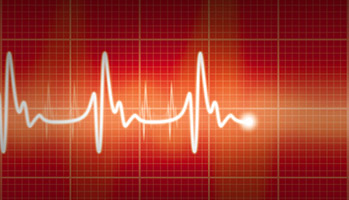 La fibrillation auriculaire, facteur de risque important de r�cidive d'AVC