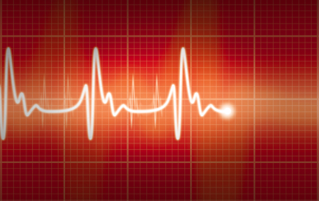 Impact de la prise chronique d'AINS sur l'incidence des vnements cardiovasculaires majeurs dans la spondylarthrite ankylosante 