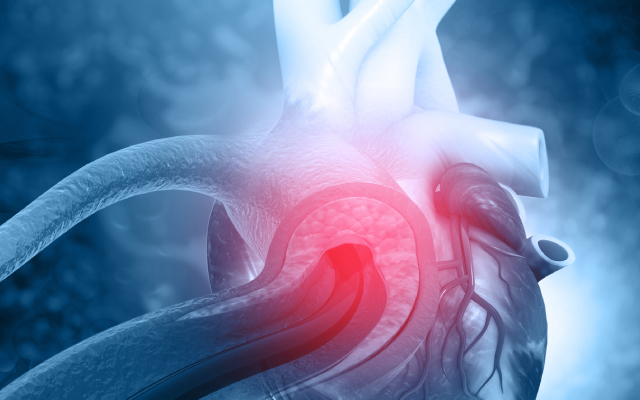 Ablation par cathter d'une fibrillation atriale dans l'insuffisance cardiaque terminale 