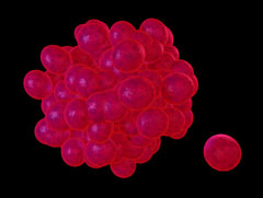 L'inhibition de l'activit� procoagulante des h�paranases par des peptides diminue la croissance tumorale et l'angiogen�se