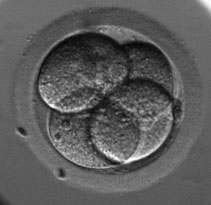 Mod�le pr�dictif pour le d�pistage de l�aneuplo�die de l�embryon humain par l�analyse d�une cellule