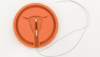 Des m�thodes contraceptives non hormonales apr�s un cancer du sein