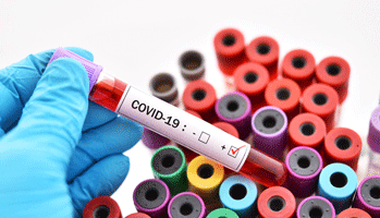 Covid-19&nbsp;; la dexam&eacute;thasone prot&egrave;ge les vaisseaux