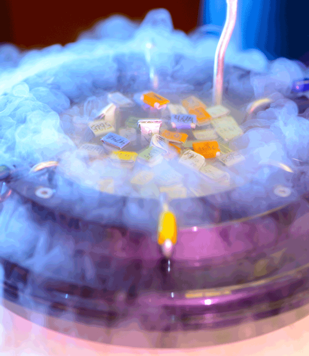 Efficacit� de la cryoconservation du tissu ovarien pour pr�servation de la fertilit�&nbsp;: le�ons tir�es de 545 cas