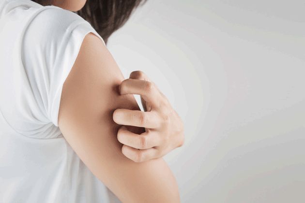 Baricitinib chez les patients prsentant une dermatite modre  svre : une tude randomise de phase 2 avec doses multiples, randomise contre placebo, en double aveugle