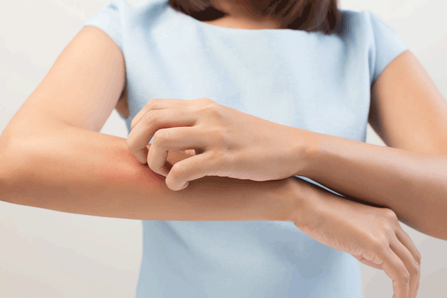 Les patients atopiques prsentent un risque accru de dvelopper de l'arthrose