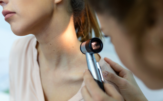 Lymphomes T cutanés chez les patients traités par dupilumab : une série de 18 patients