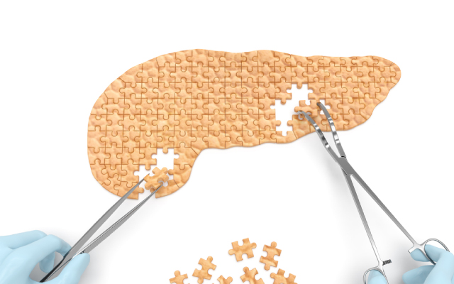 Hypercorticisme&nbsp;: modalit&eacute;s diagnostiques