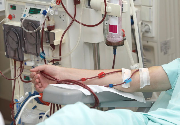 Prcision du monitorage de glucose en continu chez les patients diabtiques en hmodialyse
