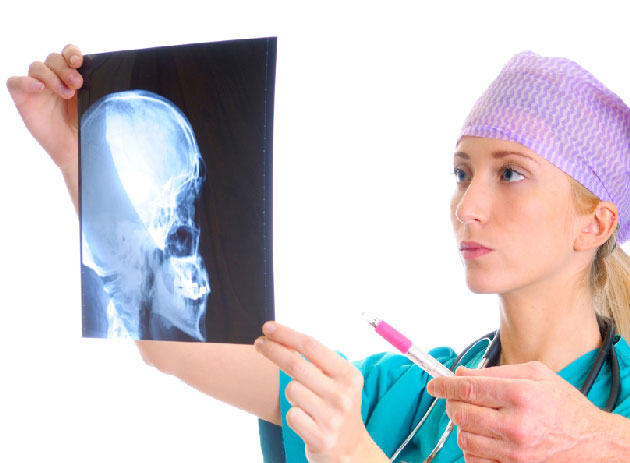 R�cidive de maladie thrombo-embolique au cours du glioblastome