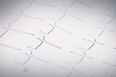 On peut am�liorer les r�sultats de l�ablation de FA en traitant de mani�re agressive les facteurs de risque. L��tude ARREST AF