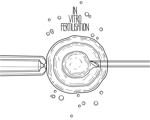 Les femmes infect�es par le VIH 1 ont des taux de succ�s en Assistance M�dicale � la Procr�ation plus faibles&nbsp;: �tude cas-t�moins