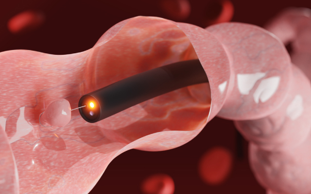 Intrt de la pr-habilitation avant chirurgie gastrique pour cancer : tude contrle