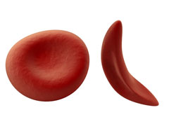 Nouvelle approche de th�rapie g�nique dans la dr�panocytose