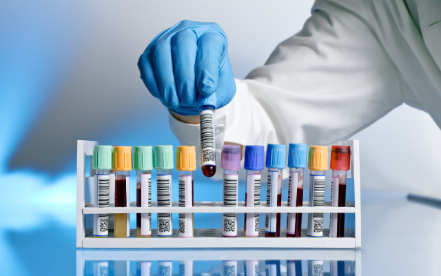 NAOS : l'acalabrutinib garde le cap en vie réelle