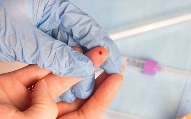 A la uneChez les patients fragiles avec un myélome multiple, traiter moins pour gagner plus ?