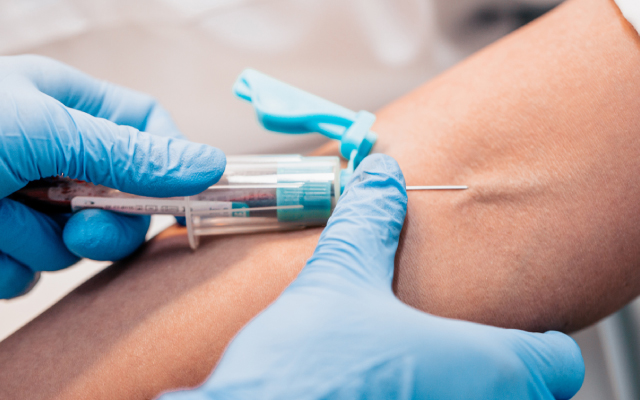 Pelabresib + ruxolitinib&nbsp;: vers un nouveau standard dans la my&eacute;lofibrose&nbsp;?