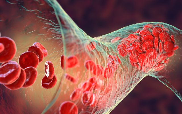 Effet de l'atorvastatine dans la prvention de la cardiotoxicit lie aux anthracyclines