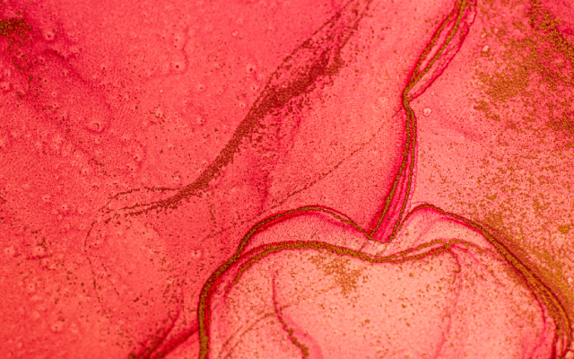 Caract&eacute;ristiques et r&eacute;sultats de 108 biopsies r&eacute;nales chez des patients atteints de pathologie plasmocytaire&nbsp;: une s&eacute;rie de cas