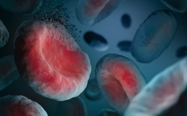 R&eacute;ponse &agrave; la chimioth&eacute;rapie d'induction dans les LAM avec r&eacute;arrangement de KMT2A et int&eacute;r&ecirc;t de la MRD