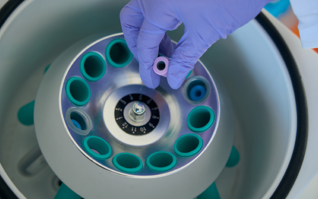 Optimisation du ciblage de CCR9 dans les LAL-T