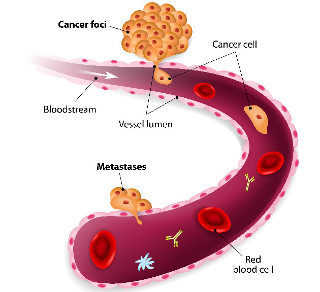 Les anticalines ciblant le VEGF&nbsp;: vers le d�veloppement d�une nouvelle classe d�antiangiog�niques&nbsp;?