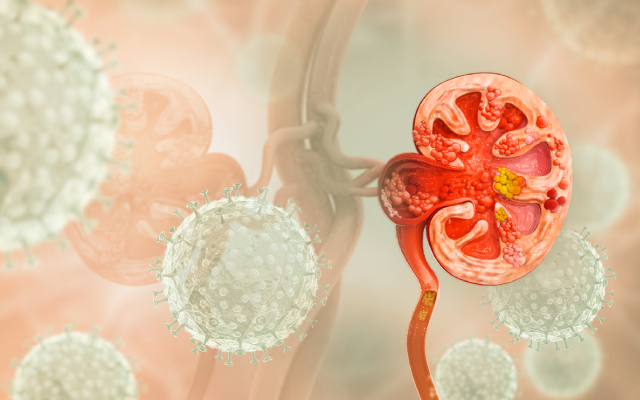R&eacute;sultats finaux de l'essai clinique de phase 3 ILLUMINATE-A sur le lumasiran dans le traitement de l'hyperoxalurie primaire