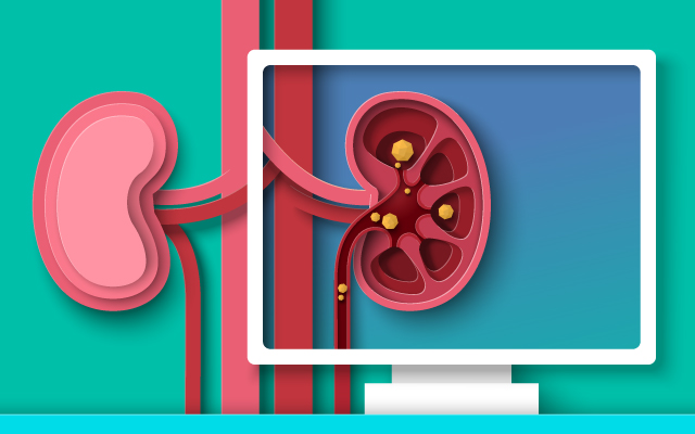 L'activité physique et son impact sur la santé cardiovasculaire chez les enfants transplantés rénaux