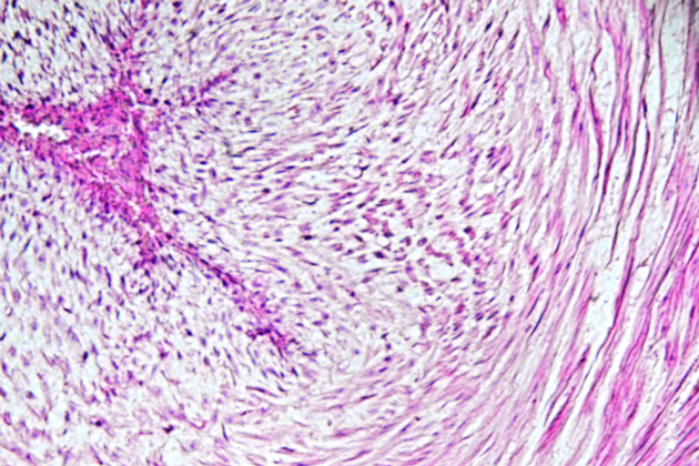 Gen�se in vitro de cellules de Sertoli et de spermatides � partir des cellules p�ri-vasculaires du cordon ombilical