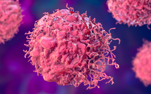 Carcinome urothélial : changement de paysage thérapeutique, oui ! Mais <i>quid</i> de la séquence ?