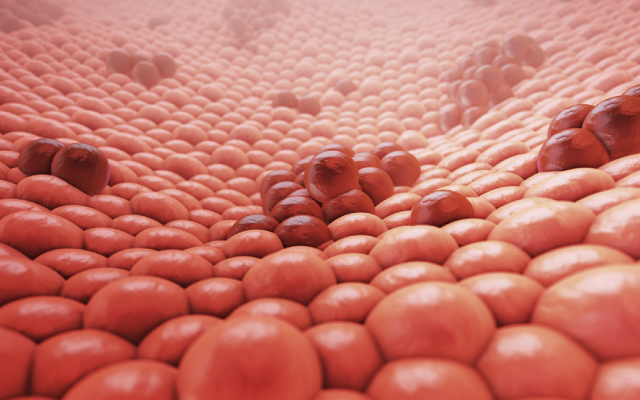 ELAINE 2&nbsp;: lasofoxif&egrave;ne + ab&eacute;maciclib dans le cancer du sein m&eacute;tastatique RH+/HER2- avec mutation ESR1