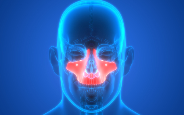 Essai de phase 3 BEACON testant un anti-PD1, le tislelizumab avec une induction, la radiochimioth&eacute;rapie puis en adjuvant des cancers du cavum localis&eacute;s &agrave; haut risque