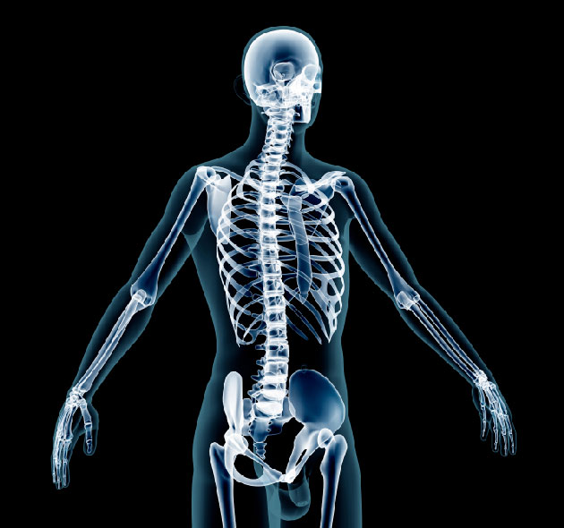 Fractures et diabte de type 2