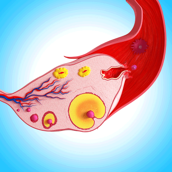 AMH et morphologie ovarienne chez 72 femmes avec hypogonadisme hypogonadotrophique isol� (HHI) ou Kallmann (KS). Effets de la FSH recombinante (FSHr) sur l'AMH, le volume ovarien et la croissance folliculaire