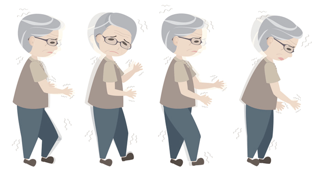 Les besoins et les exp&eacute;riences en mati&egrave;re de soins palliatifs des patients atteints de la maladie de Parkinson &agrave; un stade avanc&eacute;