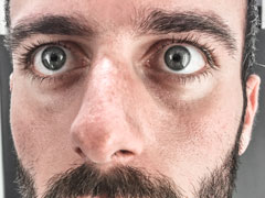 Pigmentation cutan&eacute;e induite par l'hydroxychloroquine&nbsp;: donn&eacute;es d'une &eacute;tude transversale