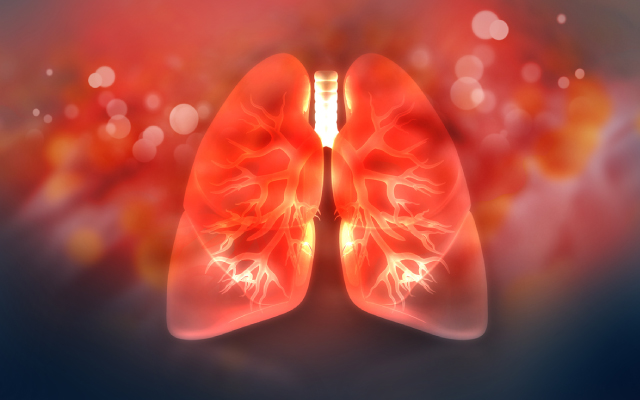 A la uneQuoi de neuf en matière d'immunochimiothérapie néoadjuvante suivie de chirurgie pour les cancers du poumon non à petites cellules (CPNPC) de stade II-III ?
