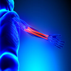 Diminution de la densit� min�rale osseuse volum�trique corticale au radius en cas de maladie art�rielle p�riph�rique