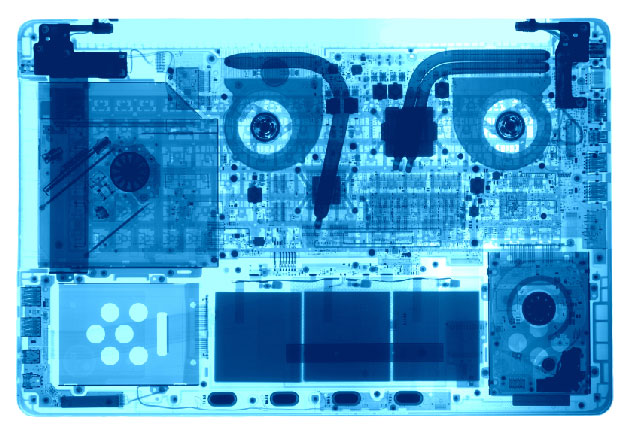 L'imagerie vasculaire associ�e � la d�tection de biomarqueurs circulants permet d'avancer dans la compr�hension des effets du bevacizumab sur la survie des patients dans le cancer du poumon non � petites cellules