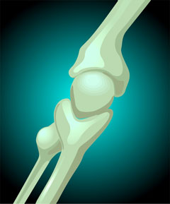 Rhumatismes inflammatoires chroniques, rituximab et risque de COVID s&eacute;v&egrave;re&nbsp;: r&eacute;sultats de la French RMD Covid-19 Cohort