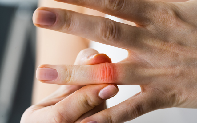 Cancers, infections, MACE : JAK inhibiteurs versus anti-TNF alpha - Les tudes de comparaison se succdent !